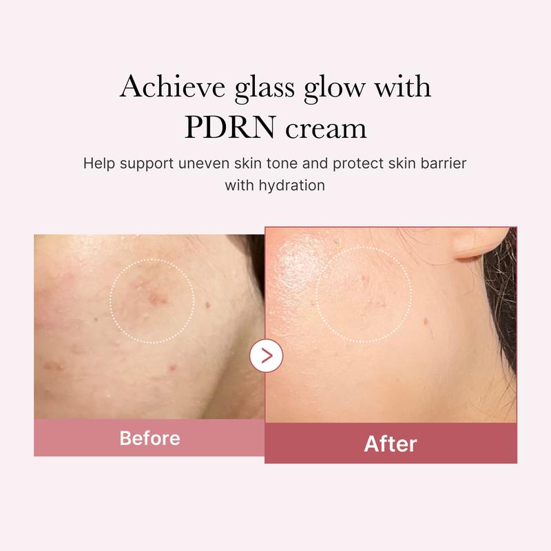 [Official Shop] PDRN Pink Hyaluronic Moisturizing CreamㅣPink Soothing CreamㅣSalmon Sperm, Salmon PDRN, Hydrating, Moisturizing, Firming, Uneven Skin Tone, Pore Care, Korean Skincare, Vegan Option