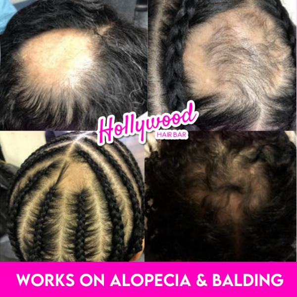 Hollywood Hair Bar Rosemary Biotin All Natural Scalp Stimulating Oil Organic Castor fine hair paraben free curly  Haircare