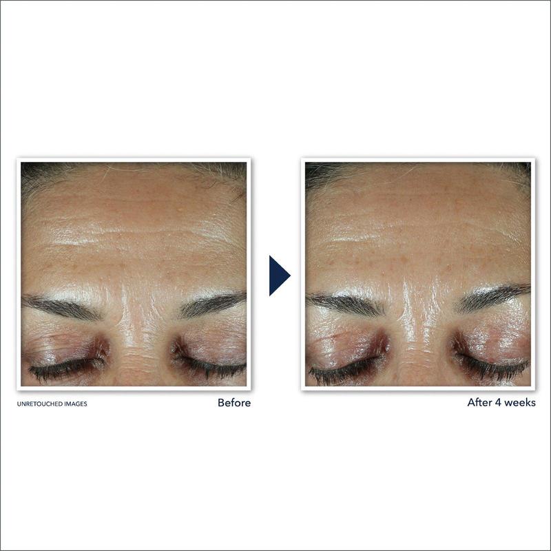 RETINOL CORREXION® Deep Wrinkle Filler