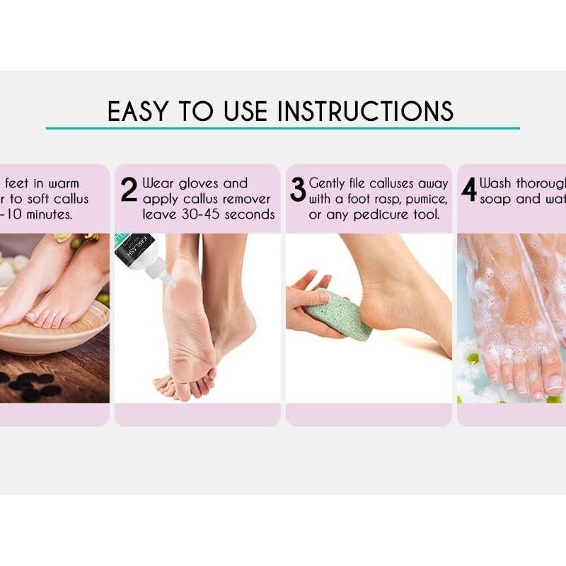 Professional Best Callus Remover Gel for Feet and Foot Pumice Stone Scrubber Kit Remove Hard Skins Heels and Tough Callouses from feet Quickly and Effortless 4 oz (1 Bottle)