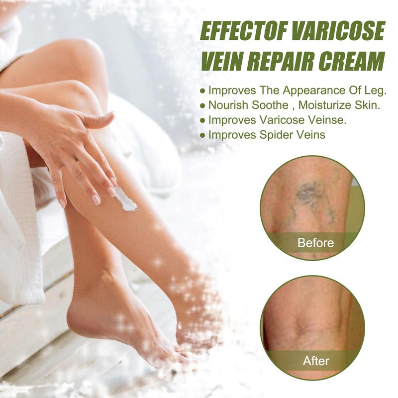 Vitamin K cream#Plant extract nourishing repair cream#Varicose veins repair relief cream#Moisturizing and hydrating lotion#Massage cream#Men and women body care. Suitable for all skin types#60g-EEA03-A030-30