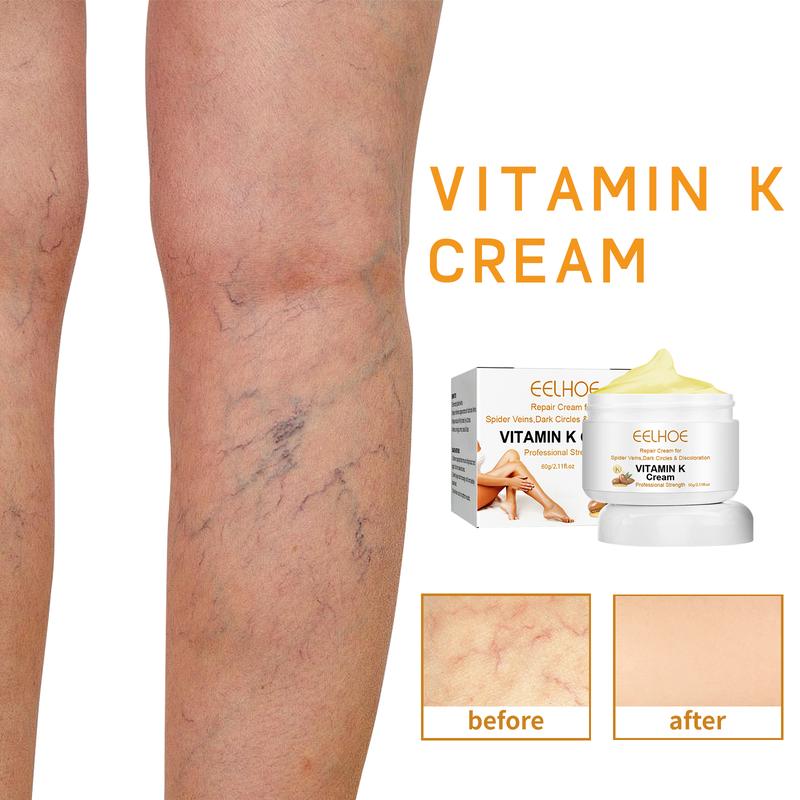 Vitamin K cream#Plant extract nourishing repair cream#Varicose veins repair relief cream#Moisturizing and hydrating lotion#Massage cream#Men and women body care. Suitable for all skin types#60g-EEA03-A030-30