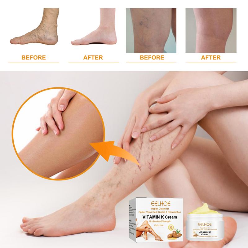 Vitamin K cream#Plant extract nourishing repair cream#Varicose veins repair relief cream#Moisturizing and hydrating lotion#Massage cream#Men and women body care. Suitable for all skin types#60g-EEA03-A030-30