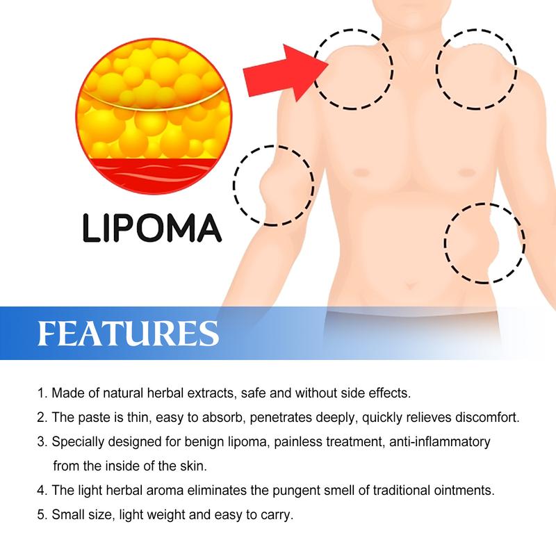 South Moon Lipoma Removal Cream, Relieve Fat Caking Tumor Subcutaneous Lumps Unclog Body Care