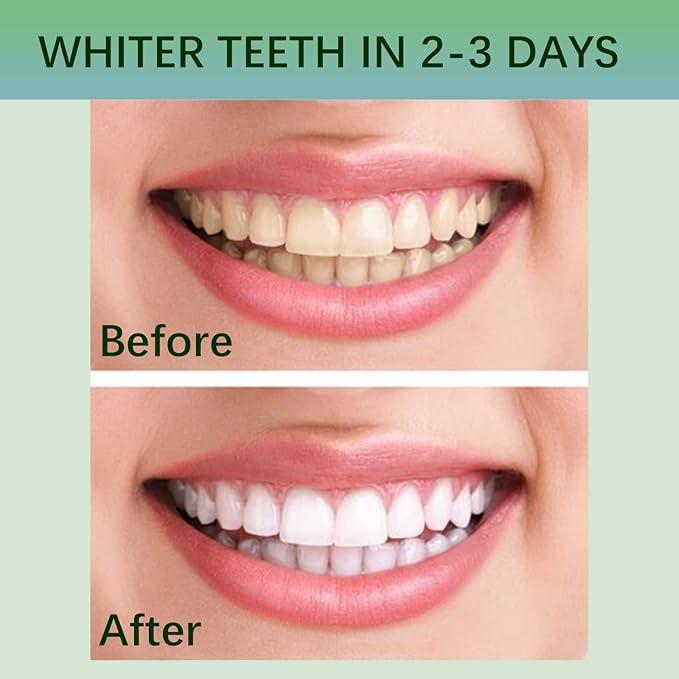 Teeth Whitening Strips for Teeth Sensitive, Non-Slip Enamel-Safe Strips, for Smoking Coffee Soda Wine Stain, 28 Strips 14 Treatments Oral Gentle Deep Cleaning