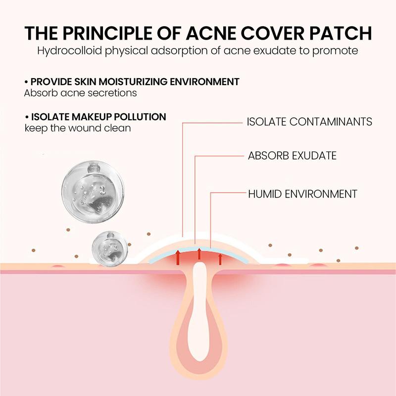 Star Shaped Pimple Patch, 200pcs box Hydrocolloid Acne Cover Patches, Facial Skin Care Patches, Acne Treatment Patches for Face