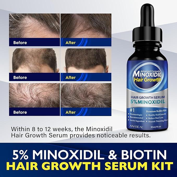 5% Minoxidil for Men and Women KIT, Minoxidil for Men Beard, Minoxidil for Men Hair, Monoxide for Men Hair, Minoxidil for Women, Minoxidil Hair Growth, Minoxidil Beard Growth Oil, Minoxidil 5 Percent