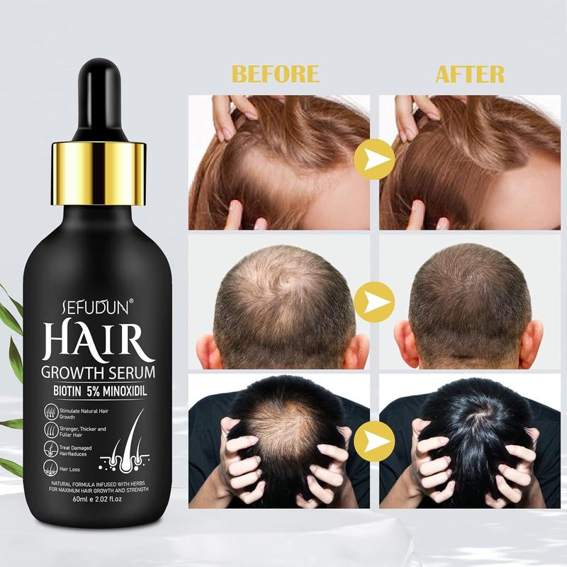 Sefudun - 5% Minoxidil for Men and Women Hair Growth Serum - Castor Oil & Biotin Hair Growth Spray Hair Regrowth Treatment for Scalp Hair Loss Hair Thinning For Thicker Longer Fuller Healthier Hair 60ML