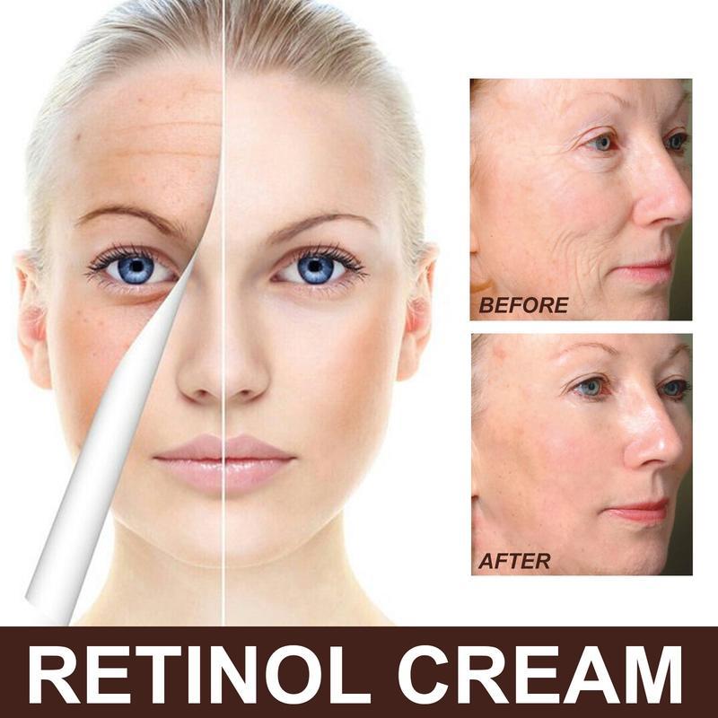 EELHOE Retinol Cream Anti-wrinkle & Anti-aging Retinol Face Cream Firming & Tightening Deep Moisture Hydrate Moisturizer Skincare