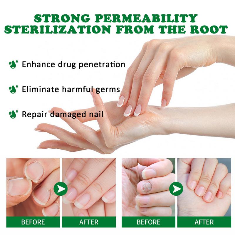 Multi-Purpose Nail Repair, Nail Solution for Discolored and Damaged Nails, 1.0fl oz nail fungus treatment