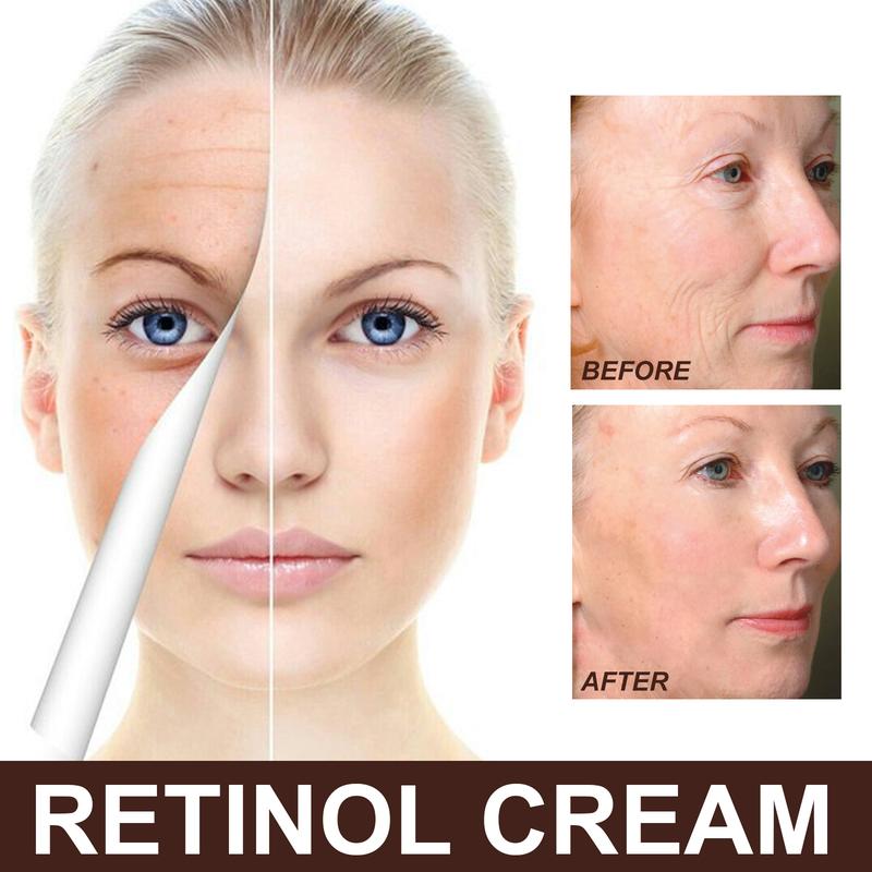 Retinol Cream Firming Facial Skin Care Moisturizer Anti-Aging Moisturize Brightening  Day or Night Hydrating Cream Skin Repair Moisture Mother's Day Gift