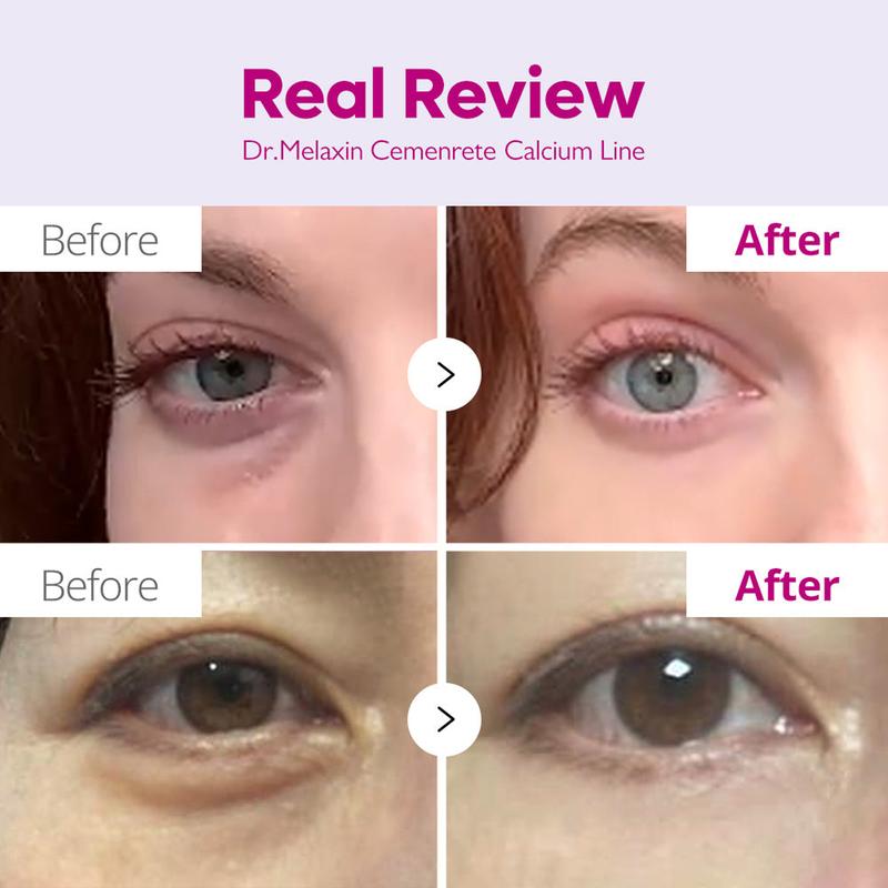 Dr. Melaxin - Cemenrete Calcium Volume Multi Balm 9g | FILLER IN A STICK