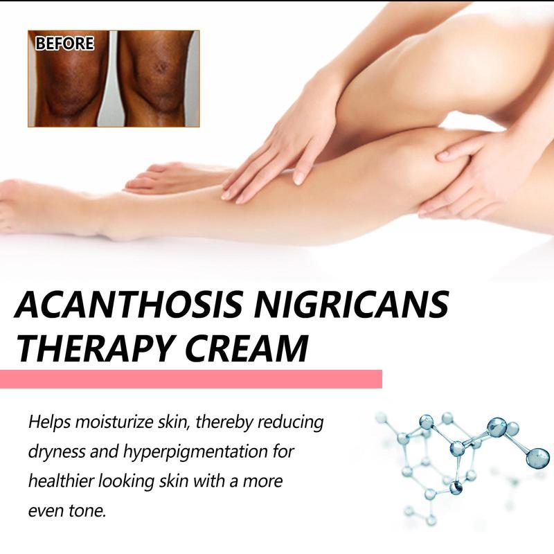 Flash sale skincare cream, suitable for discoloration of elbows, knees, knuckles, and back - men's and women's moisturizing body lotion