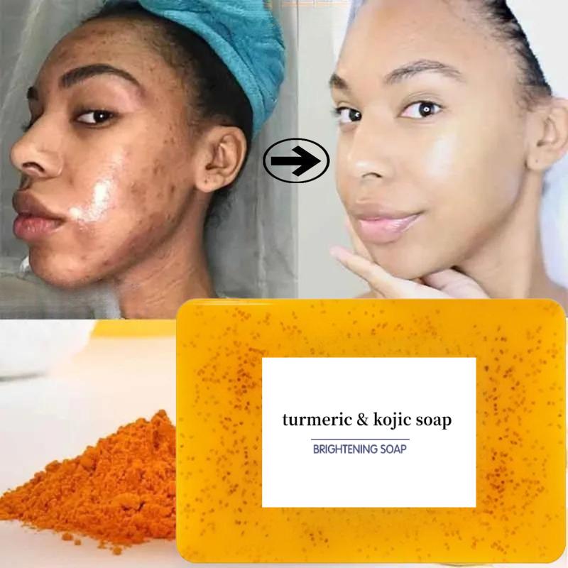 Turmeric & Kojic AcidBrightening Soap, Kojic Acid Soap, SoapBody Care Body Wash Lemon FlawlessOrganic Facial Cleansing Skincare SkinRepair Radiant