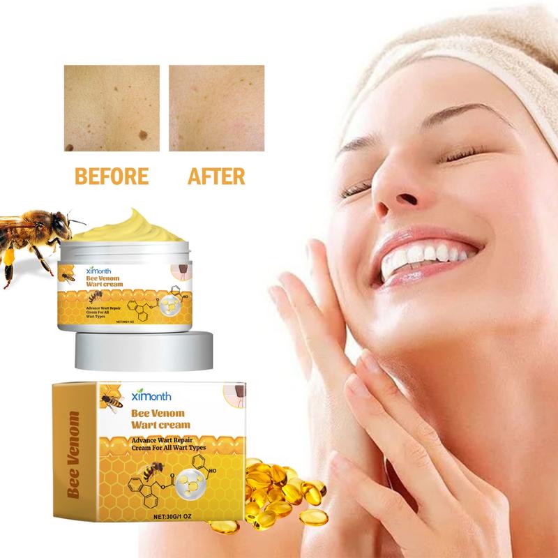 Bee Venom Wart Cream | Fast & Painless Wart Removal | Skin Smoother with Natural Ingredients Acne Skincare