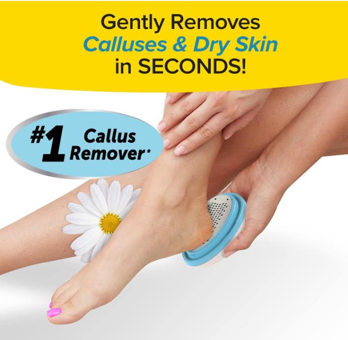 PedEgg Classic Callus Remover, As Seen On TV, New Look, Safely and Painlessly Remove Tough Calluses & Dry Skin to Reveal Smooth Soft Feet