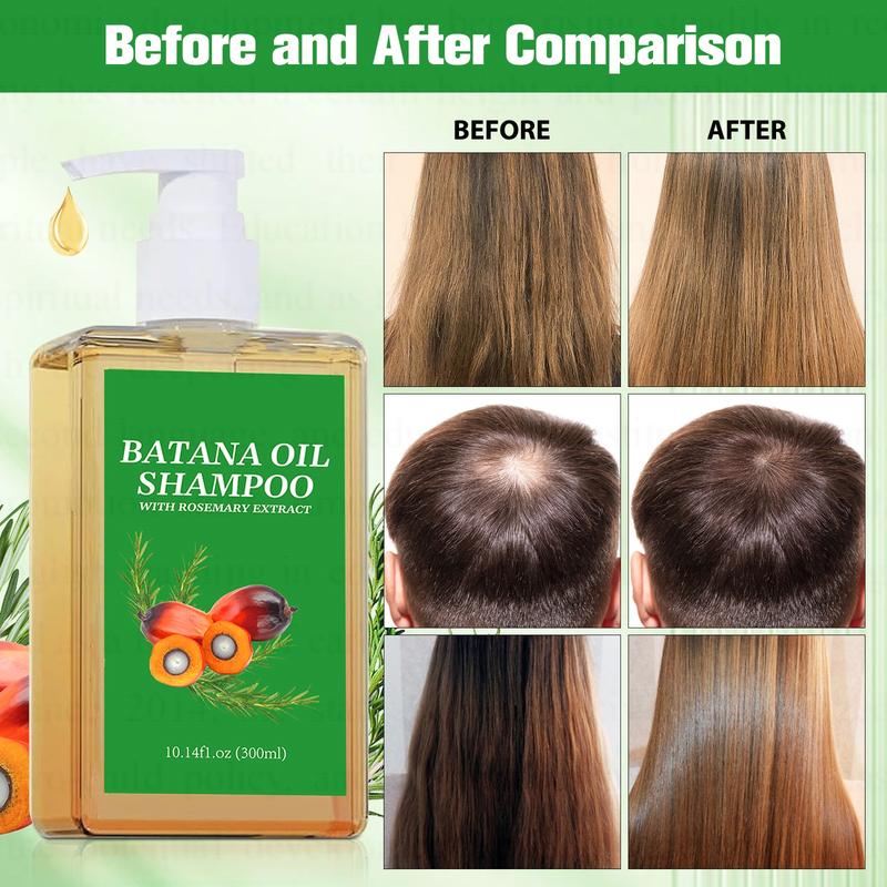 [Christmas limited time special] Combination package Batana Oil Shampoo, natural treatment toreduce hair loss and promote hair growth(10.14 0z 300 g),A favorite Christmas gift for boys and girls