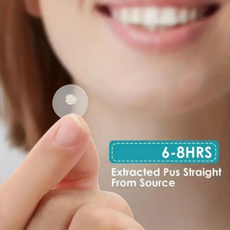 Acne Patch, 360pcs set Invisible Acne Covering Sticker, Facial Skin Care Product for Women & Men