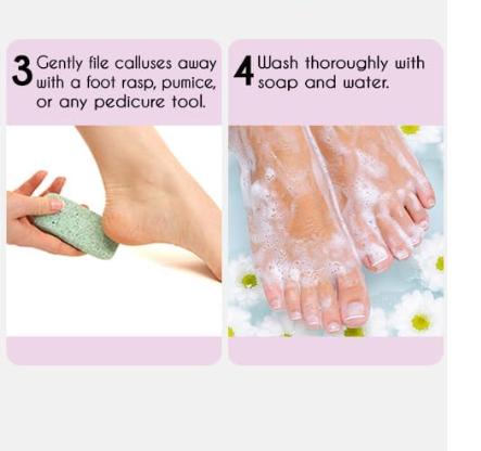 Professional B.est Callus Remover Gel for Feet and Foot Pumice Stone Scrubber Kit Remove Hard Skins Heels and Tough Callouses from feet Quickly and Effortless 4 oz (1 Bottle) Manicure Nail Nail Care Smooth